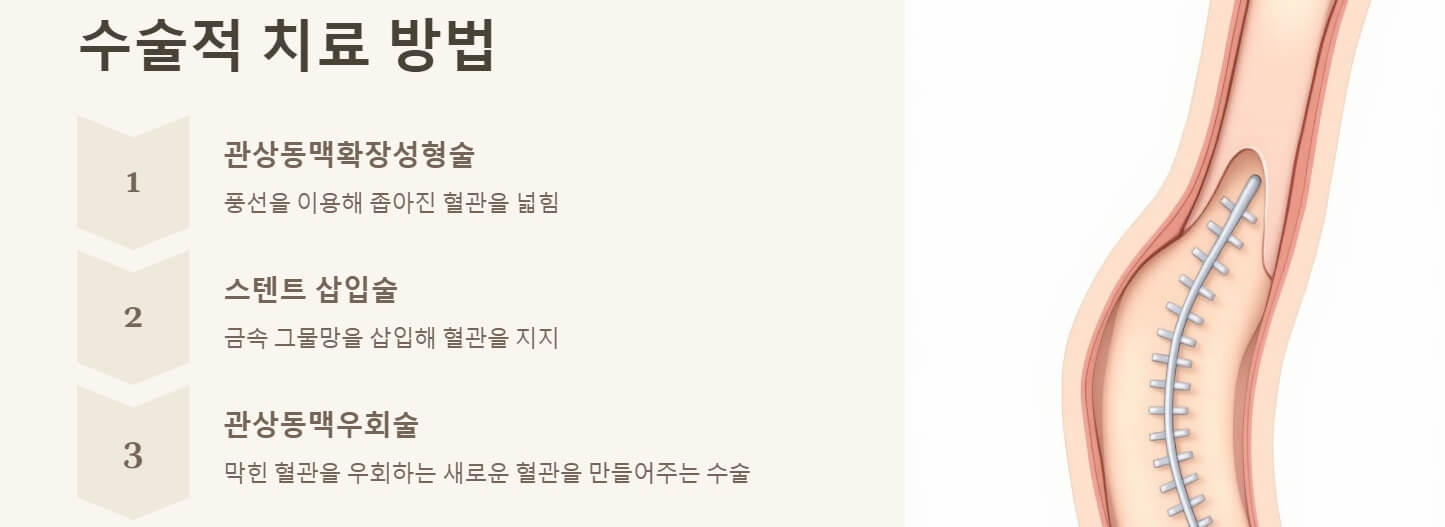 협심증 초기증상 치료방법 좋은 음식