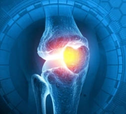 류마티즘의 증상과 원인 및 식습관과의 관계와 치료법 고찰