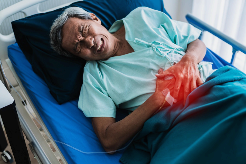 과민성 장증후군(IBS)