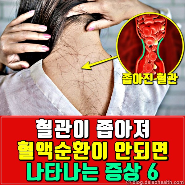 혈액순환이 안되는 느낌,피가 안통하는것같은 증상,건강