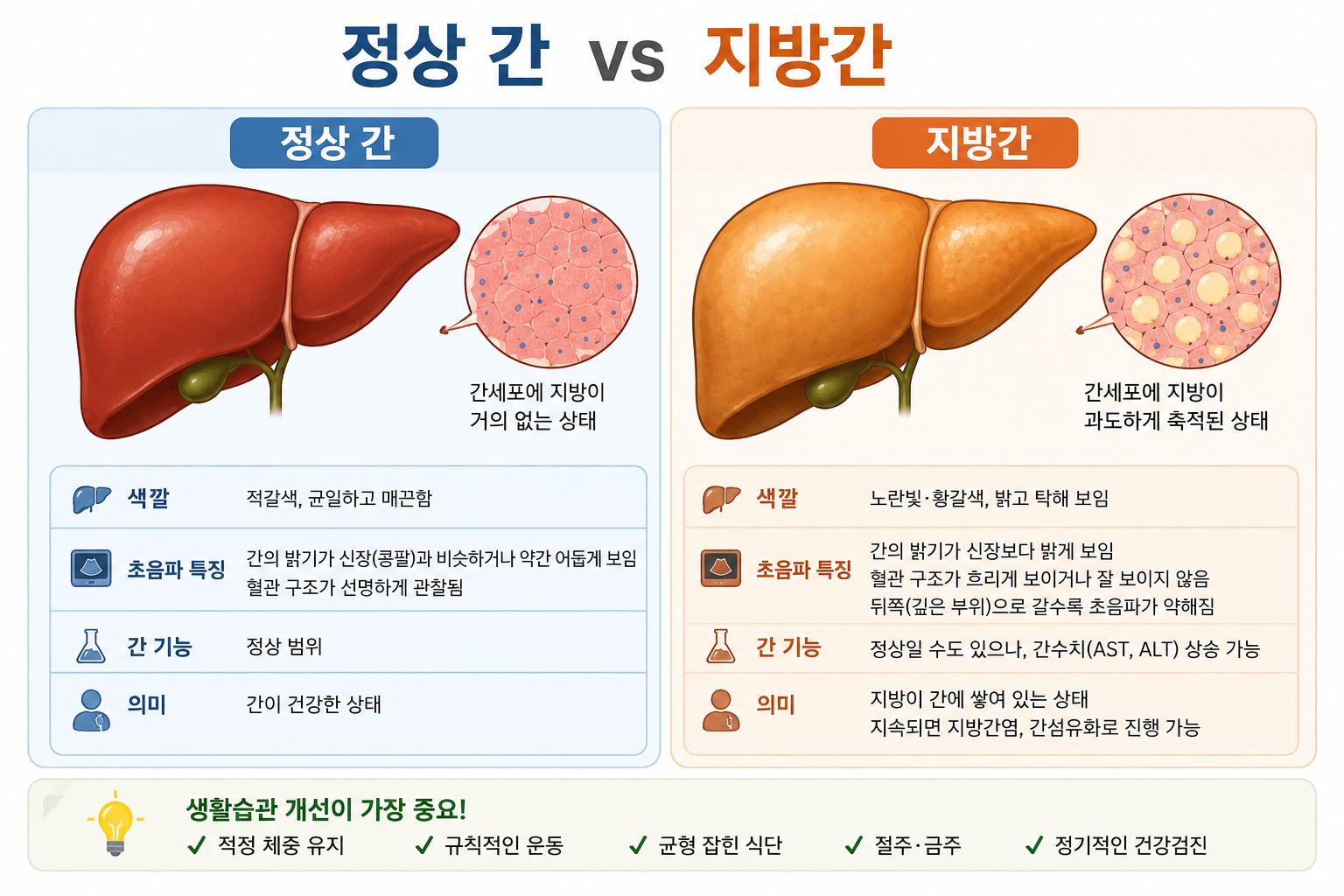 복부초음파 지방간 단계별 설명