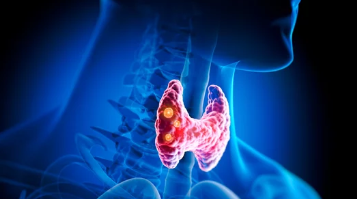 갑상선기능저하증/출처:어도비스톡