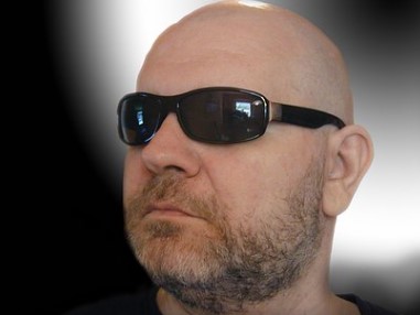 원형탈모 치료 후기