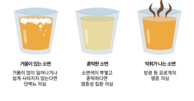 오줌 색깔과 병