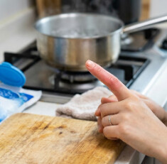 How to deal with finger burns first degree burn symptoms, causes, pain and treatment