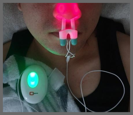 코에픽 부작용 효과