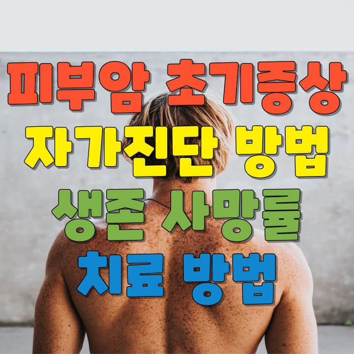 피부암 초기증상 자가진단 샌존 사망률