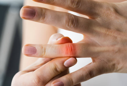 손가락 마디 통증