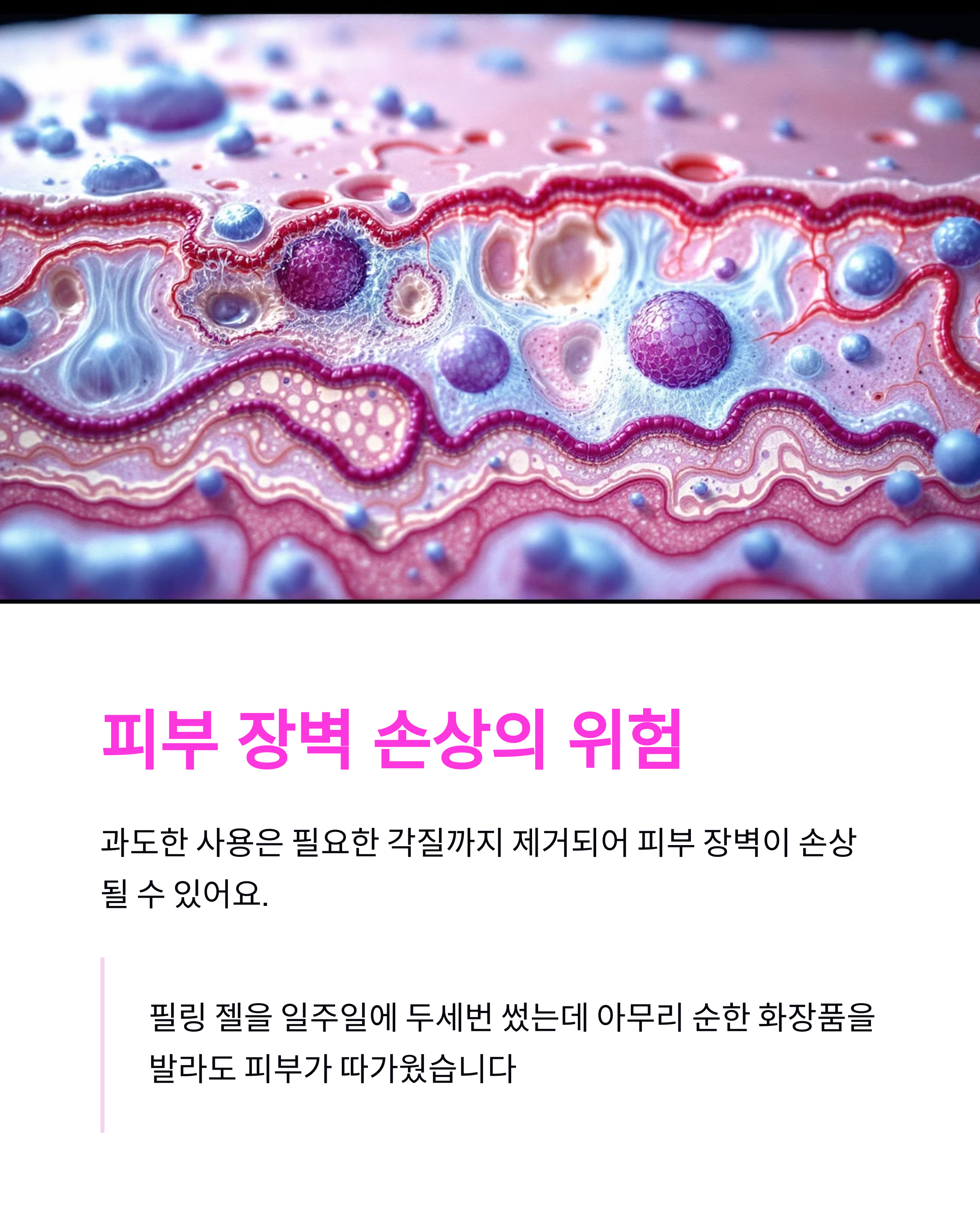 필링젤의 장점과 숨겨진 단점들: 알고 사용하세요!