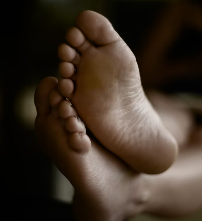 발톱무좀 실비보험