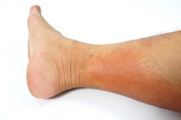 묘기증 증상과 특징