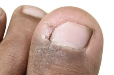 발바닥통증의 원인 9