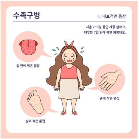 수족구병