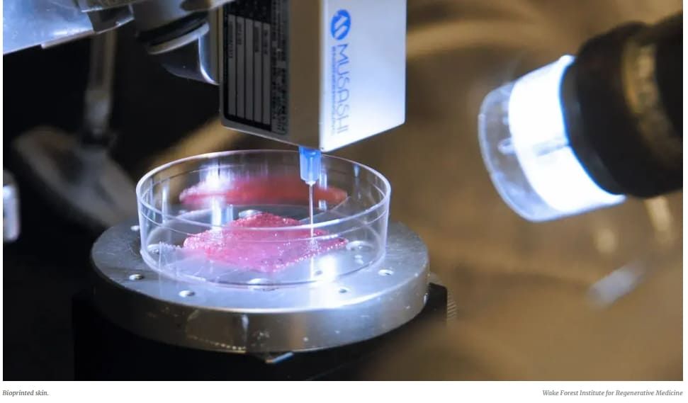 바이오&nbsp;프린팅&nbsp;피부, 부상&nbsp;치료 등에 이식 가능해질 듯: 웨이크&nbsp;포레스트&nbsp;대 VIDEO: Bioprinted skin heals severe wounds in pigs, humans are next