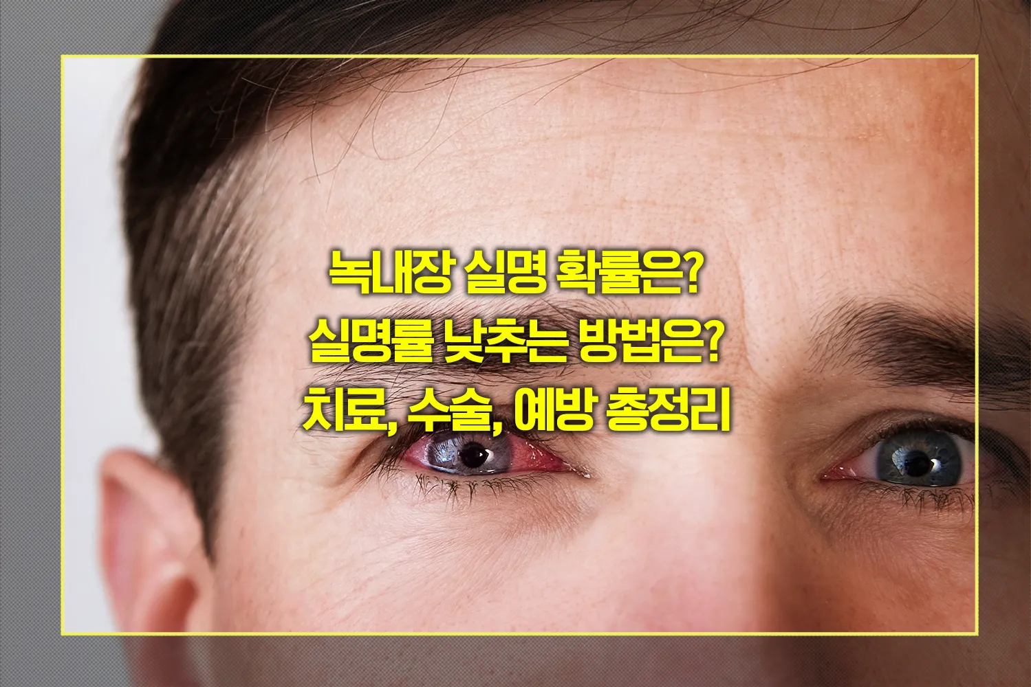 녹내장-실명-확률과-예방방법