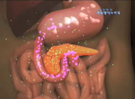 당뇨병 발생 원인