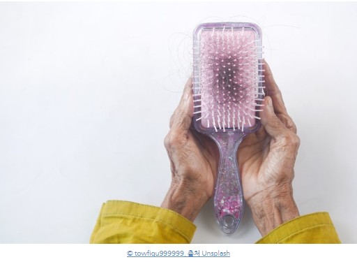 탈모로 인한 머리빠짐