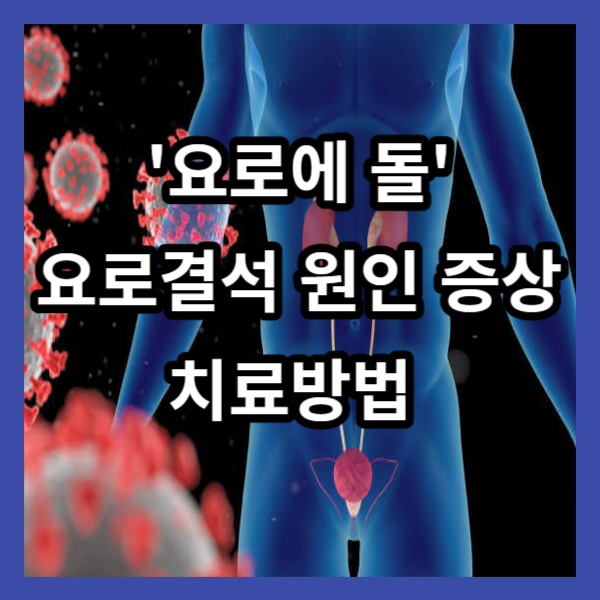 요로에 돌 요로결석 원인 증상 치료방법