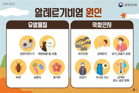 비염