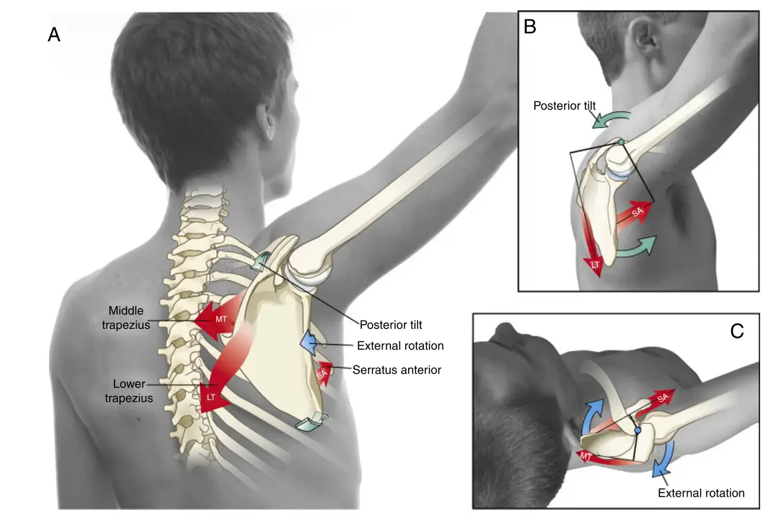 견갑골 운동이상증(Scapular Dyskinesis): 어깨 통증의 숨겨진 원인과 효과적인 운동법