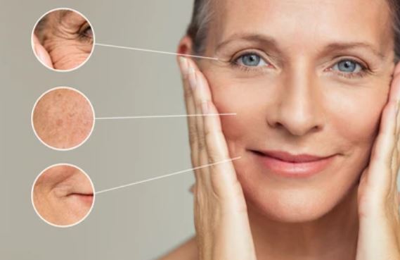 팔자주름 생기는 원인