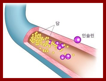 공복혈당 낮추기