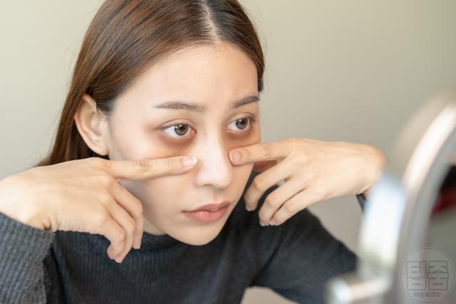 눈밑 지방 다크서클 원인