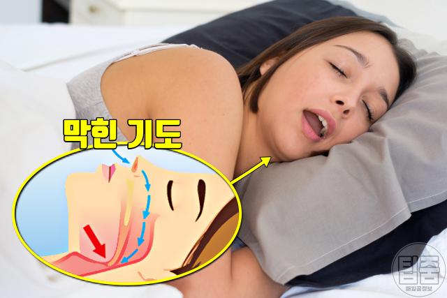 폐경 후 여성 질환 질병 수면무호흡증
