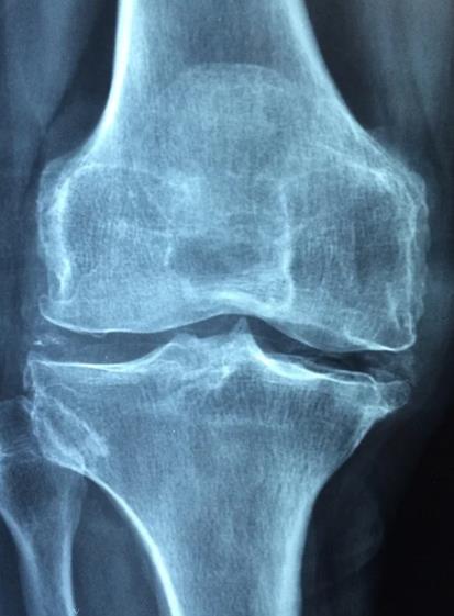 관절_호관원 프리미엄 가격