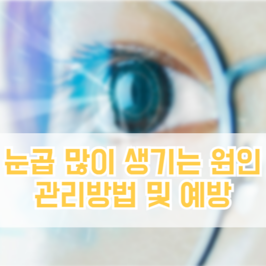 눈곱 많이 생기는 원인, 관리방법 및 예방