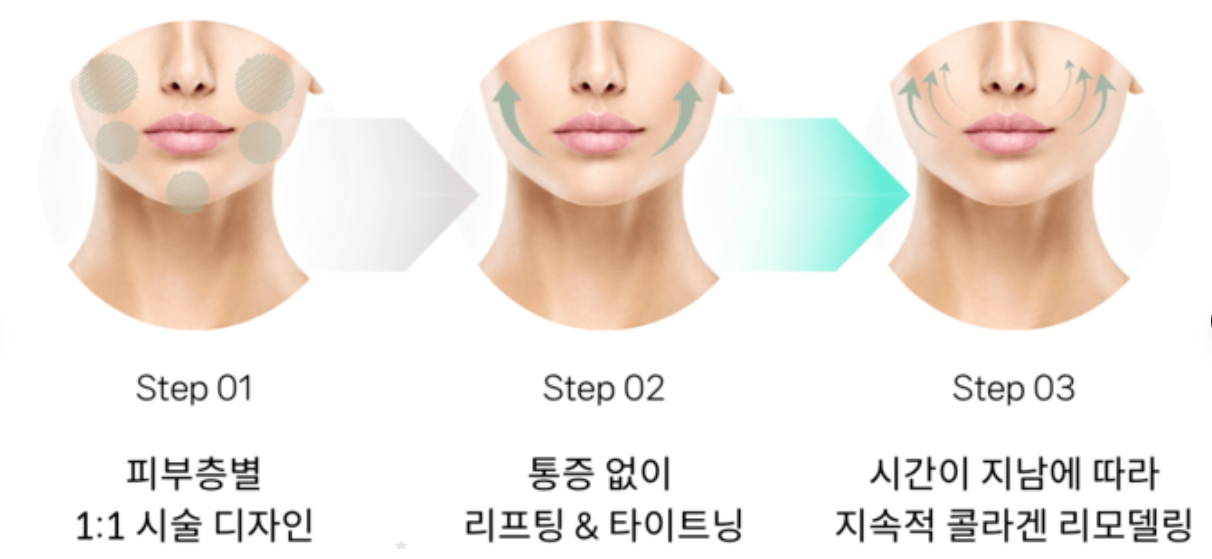 온다리프팅6만줄가격 통증 효과 부작용 이중턱 심부볼 타이트닝 전후 차이 세밀하게 비교 분석하기