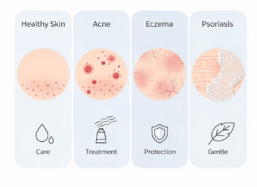 편평사마귀 없애는 방법