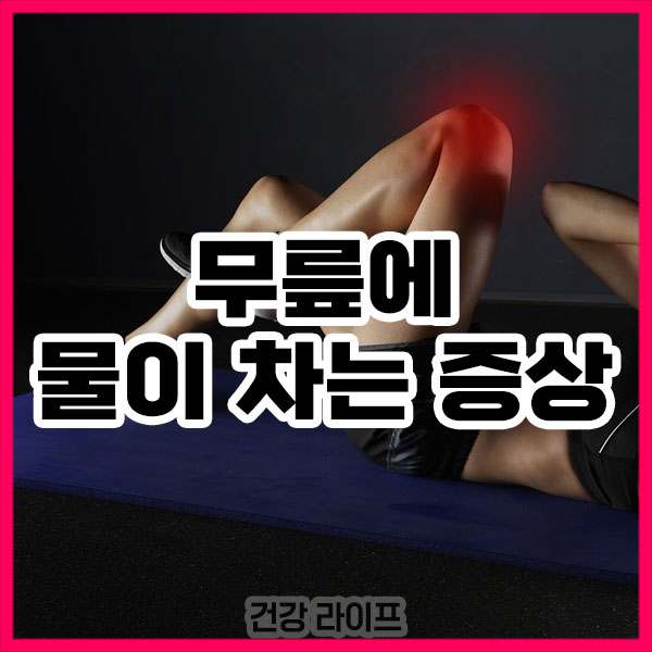 무릎에 물이 차는 증상