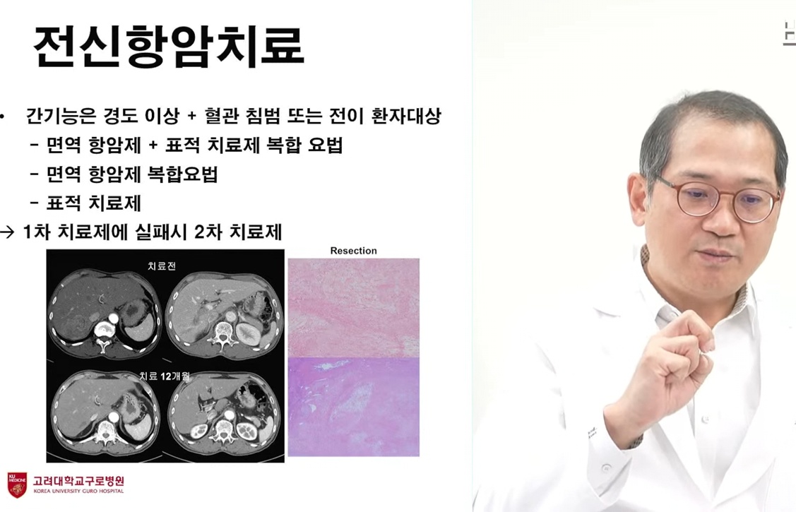 명의-지방간염-김지훈-교수