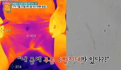 무좀우범지대