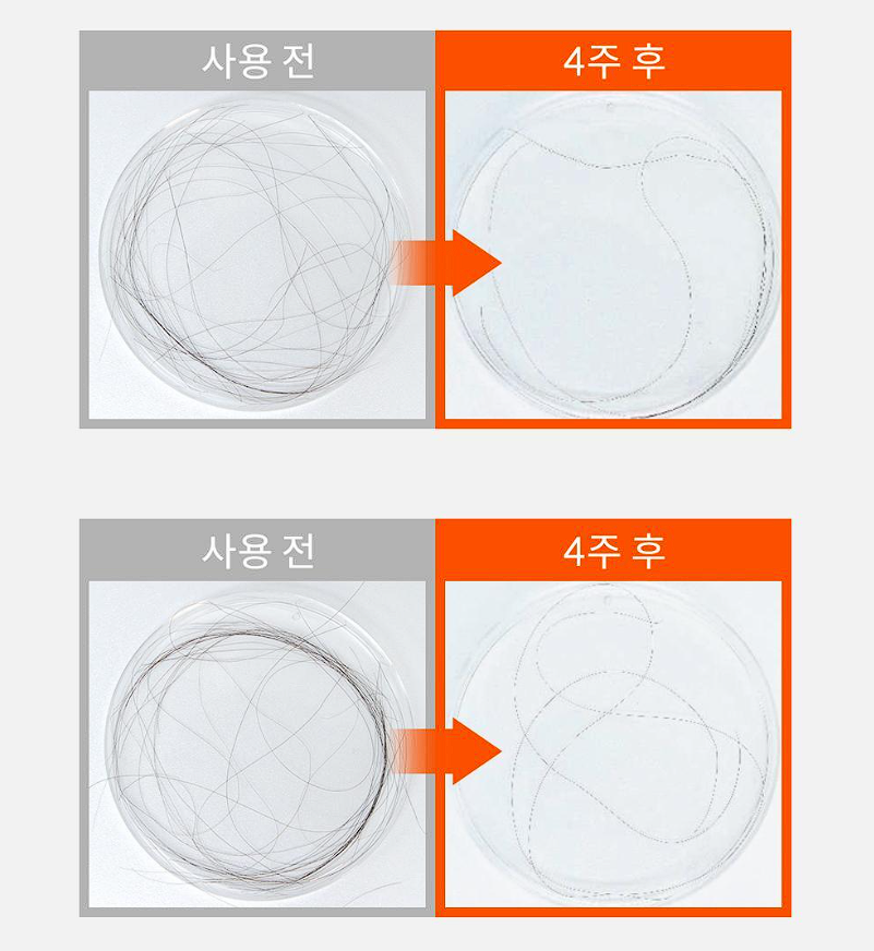 그로우턴 앰플 내돈내산 후기