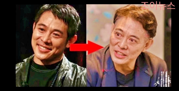 안구 돌출로 인한 배우 이연걸의 외모 변화_출처: EBS 다큐 유튜브