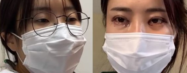 이세영 성형수술