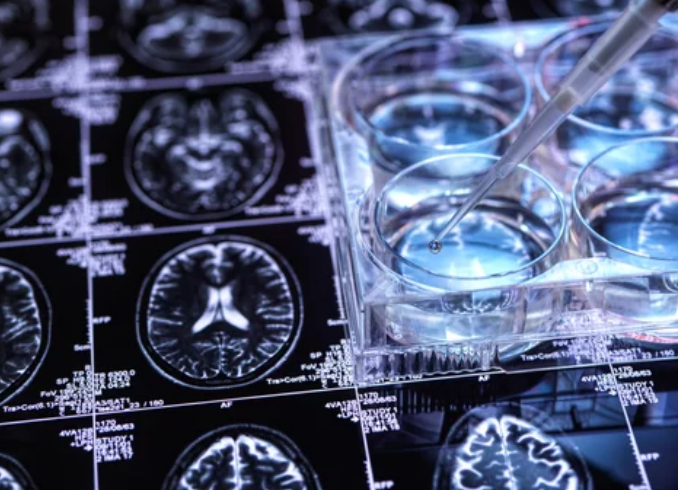 알츠하이머 단백질 소통 독성 조절 연구 결과