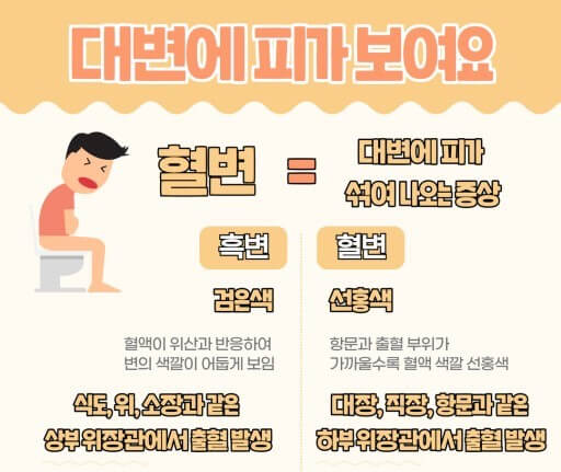 대변 관찰의 습관화
