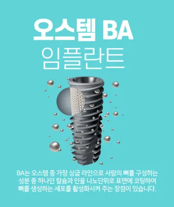 오스템 임플란트 수명 시술기간_20