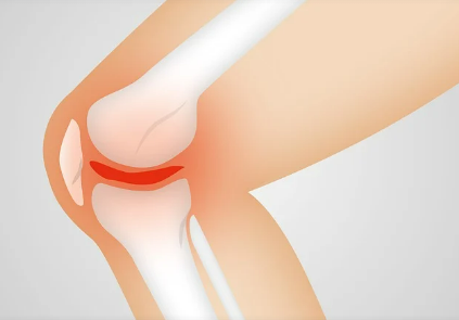 관절영양제-콘드로이친