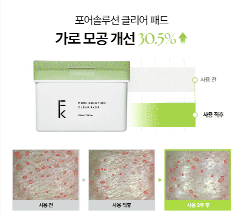 포어솔루션 클리어 모공 패드 사용 후기