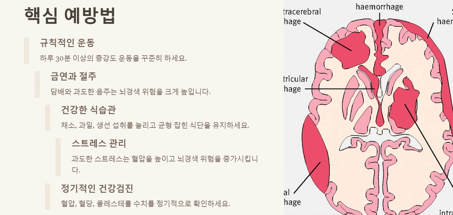 뇌경색 초기증상 치료방법