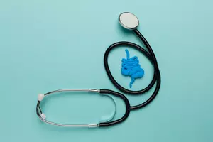 대장암-4기-생존율