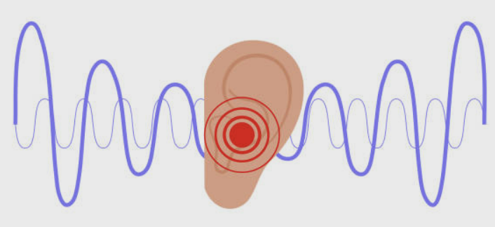 이명 치료방법 증상 원인 좋은 음식 등 총정리(2024 최신)