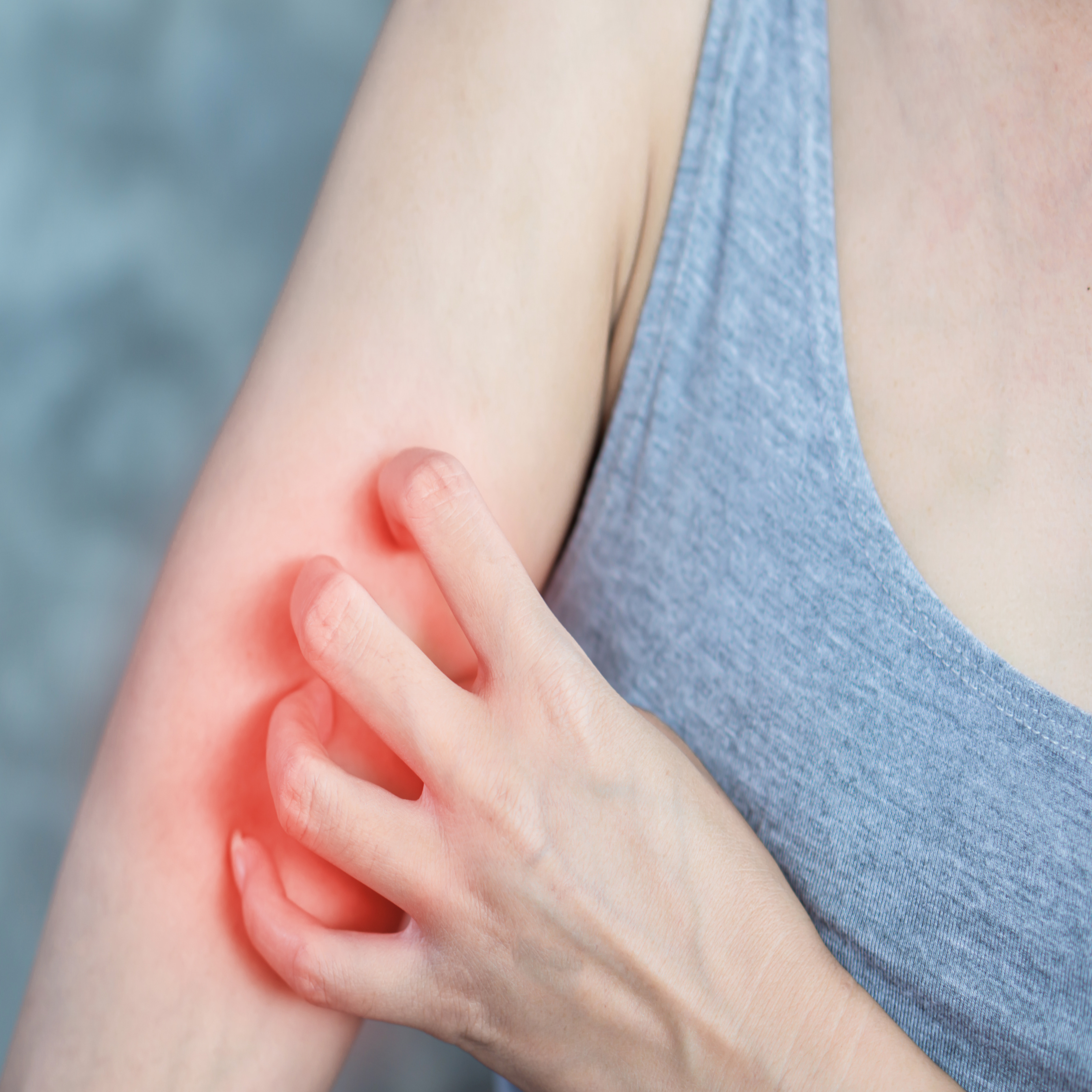 대상포진 원인과 치료법 (예방, 초기증상, 치료)