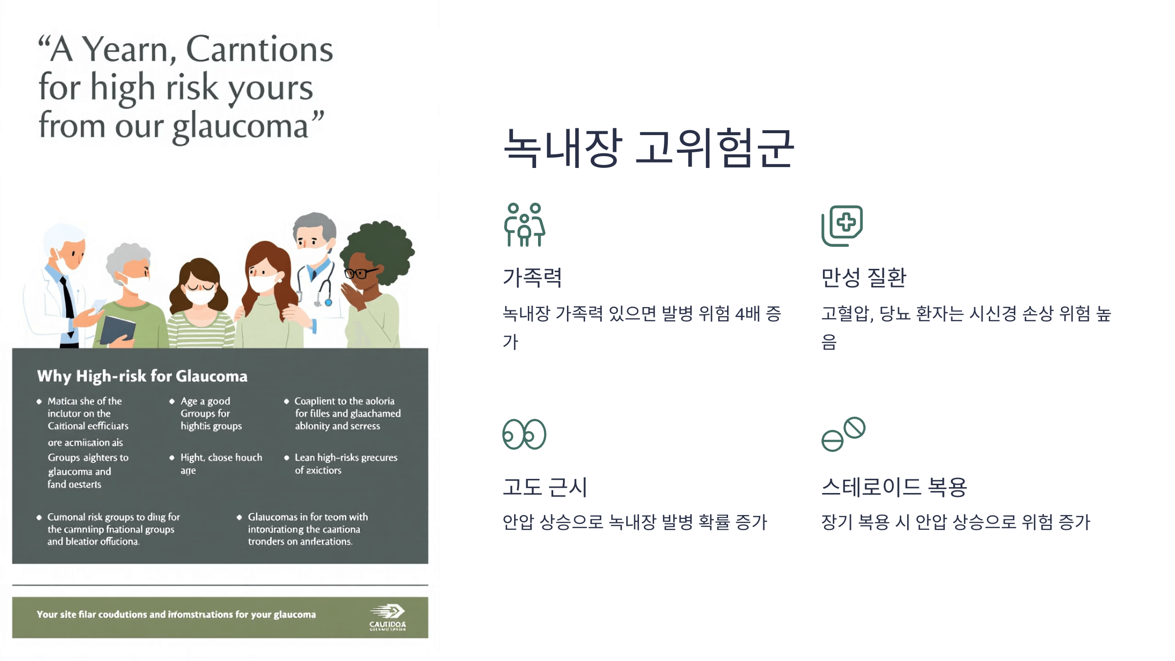 녹내장과 관련된 사진입니다.