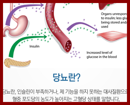 공복혈당 낮추기