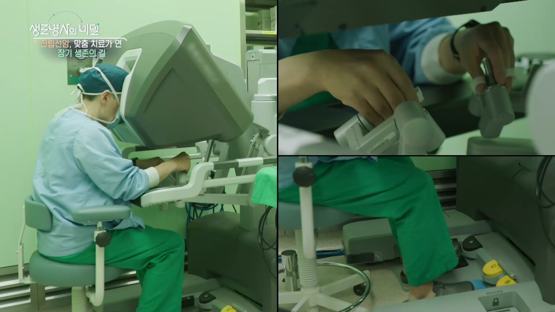 생로병사의 비밀 전립선암